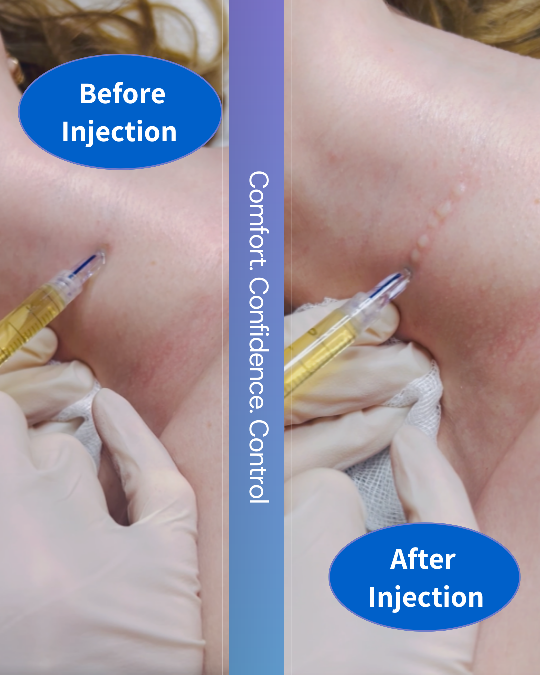 Micronjet 0.6mm needle (30pcs/1box)
